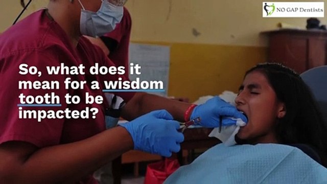 Why Remove Wisdom Teeth Only When They’re Impacted