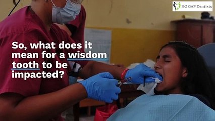 Why Remove Wisdom Teeth Only When They’re Impacted
