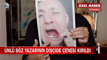 Ünlü söz yazarının dişçide çenesi kırıldı