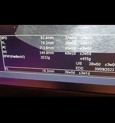 4 Male ♂️Gender at 37_38 Week with Difficult Sex Determination