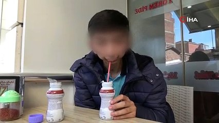 Alt çenesi yok, dişleri üst damağında: Ameliyat için yardım bekliyor