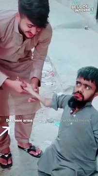 Mind-Bending Arm Twists: No Pain, Just Flexibility! || Best of Internet