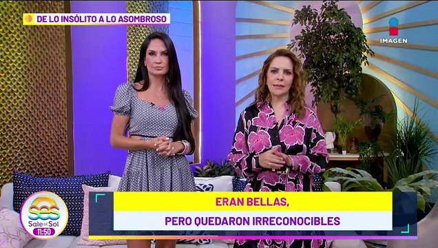 Famosas que arruinaron su cara con cirugías estéticas