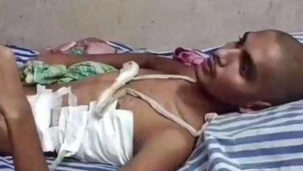 सहरसा: बेखौफ बदमाशों का आतंक, युवक को मारी गोली