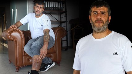 Girdiği ameliyatta bacağında unutulan parçayla 16 yıl yaşadı!