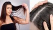 Oily Hair Dry Scalp क्यों होता है | Reason Of Oily Hair |Oily Hair Dry Scalp Ko Theek Krne Ka Tarika