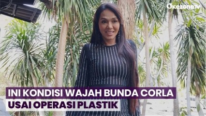 Intip Penampilan Terbaru Bunda Corla Usai Operasi Plastik pada Bagian Wajah