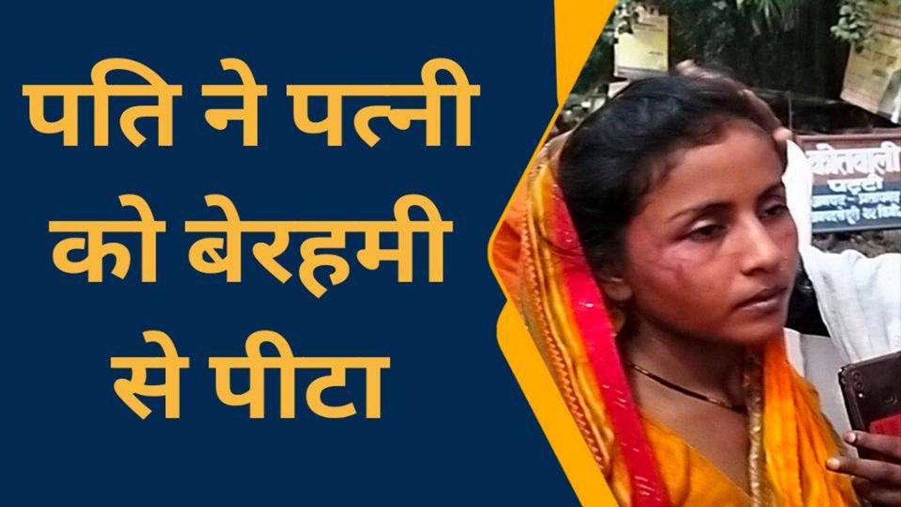 प्रतापगढ़: दूसरी महिला के चक्कर में बेरहम पति ने पत्नी का फोड़ा चेहरा, खाकी से लगाई गुहार