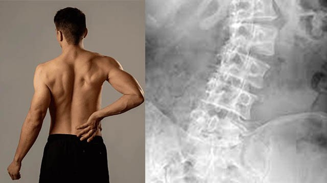 Face Under Arms Freakles से लेकर Uneven Bone Shape, Brain Tumour Symptoms | Expert Advice| Boldsky