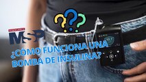 ¿Cómo funciona una bomba de insulina? - #ExclusivoMSP