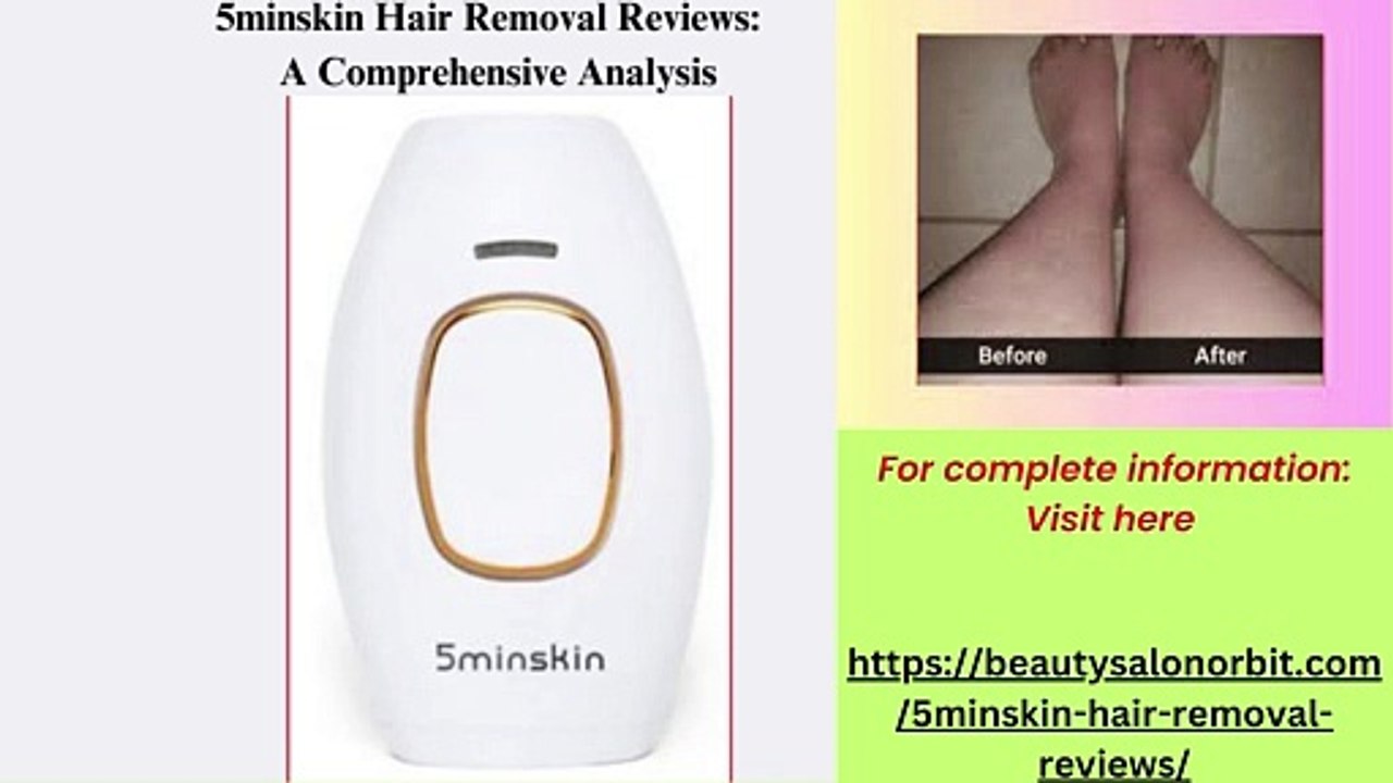 5minskin Hair Removal Reviews: A Comprehensive Analysis - video Dailymotion