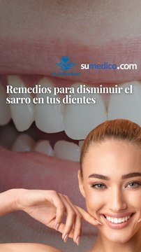 Remedios para disminuir el sarro en tus dientes