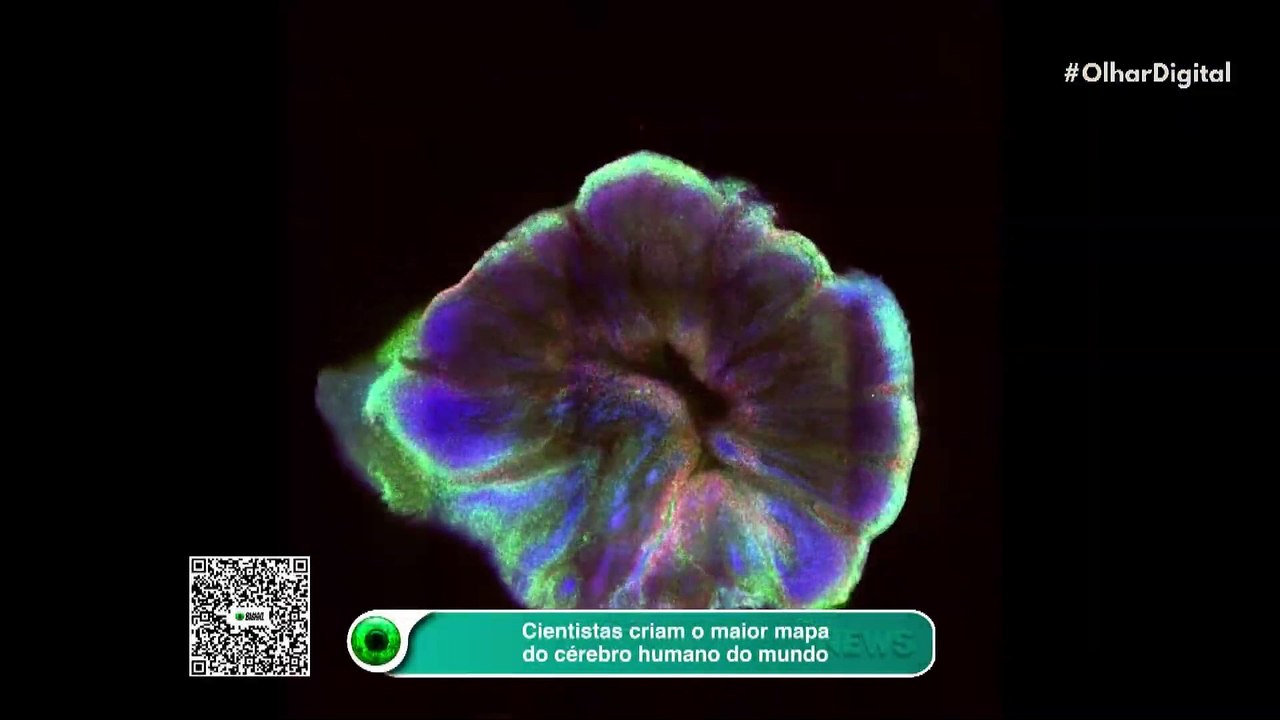 Cientistas criam o maior mapa do cérebro humano do mundo