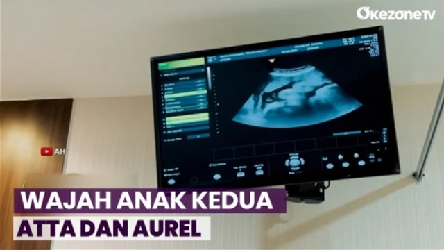 Atta Halilintar dan Aurel Hermansyah Ungkap Wajah Calon Anak Kedua
