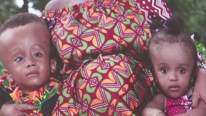 La Société Ivoirienne de Neurochirurgie sensibilise contre le Spina-bifida et l'hydrocéphalie