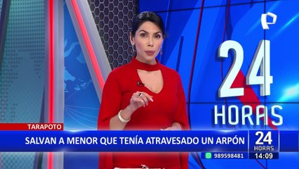 Tarapoto: Médicos salvan la vida a menor que tenía un arpón incrustado en el abdomen