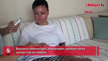 Çocukluk hayaliydi şimdi aynaya bakamıyor! Liseli Beyzanur'un hayatını karartan olay