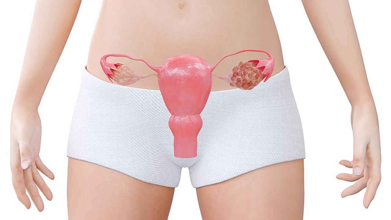 bd-causas-y-tratamientos-de-los-quistes-en-los-ovarios-271023