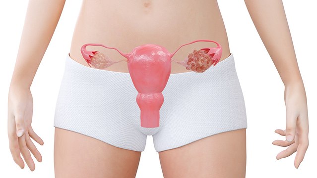 bd-causas-y-tratamientos-de-los-quistes-en-los-ovarios-271023