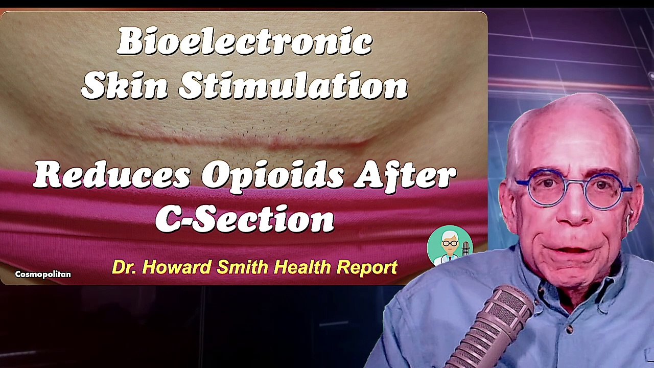 Bioelectronic Skin Stimulation Reduces Opioid Need After C-Section ...