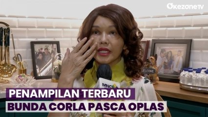 Bunda Corla Makin Cantik Pasca Operasi Plastik, Intip Before Afternya