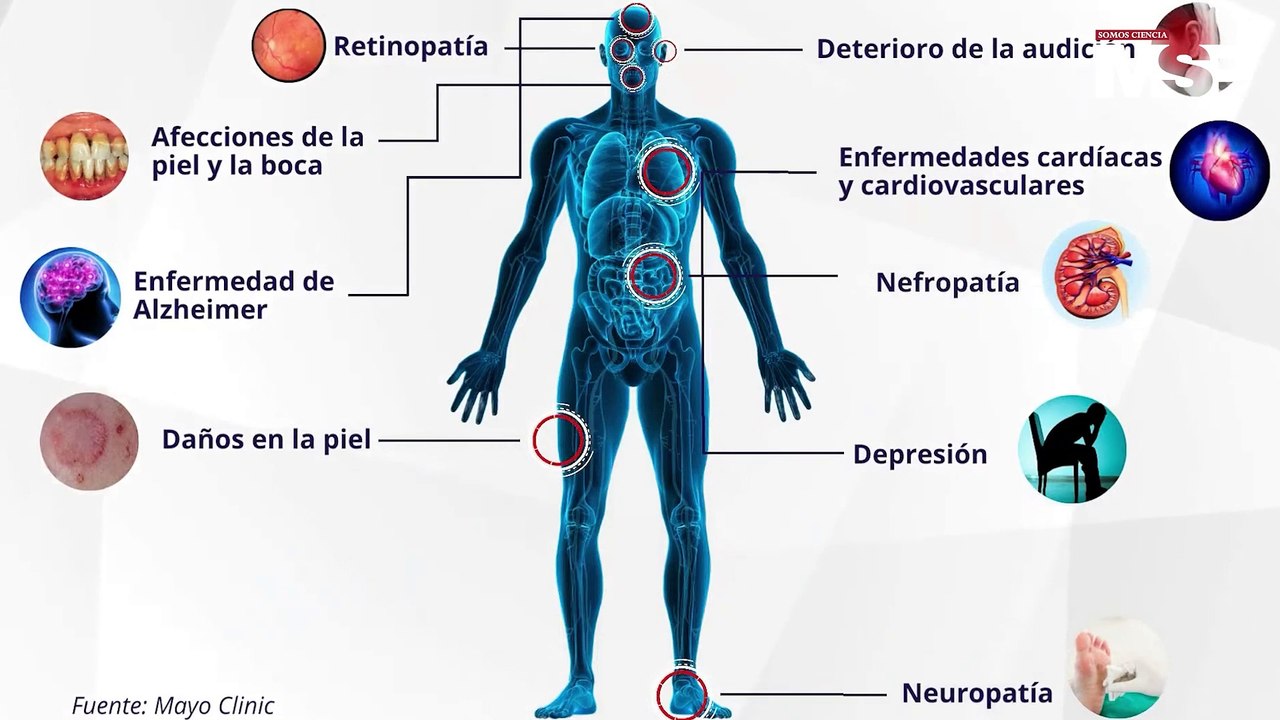 Abordando las complicaciones microvasculares de la diabetes más allá de los síntomas