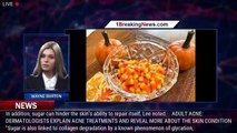 Halloween candy is not a treat for aging skin, experts say: 'Can do a