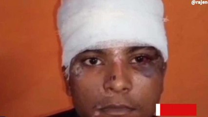 जबलपुर: अवैध वसूली को लेकर युवक पर तलवार से हमला, देखें वीडियो