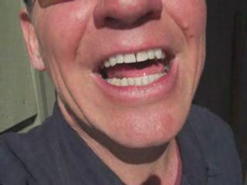 Halitosis: The Truth About Halitosis & Bad Breath