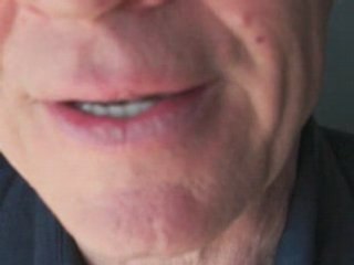 Gum Disease: Understanding Causes and Natural Treatment Options