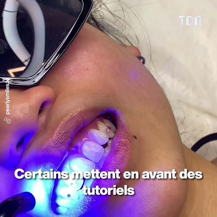 Strass sur les dents : attention à cette tendance