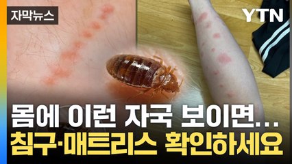 [자막뉴스] 몸에 이 자국 보인다면...당신 집에 '빈대'가 있다 / YTN
