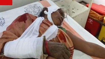 रोहतास: देवर ने भाभी को पीट-पीट कर किया लहूलुहान, इलाज के लिए अस्पताल में