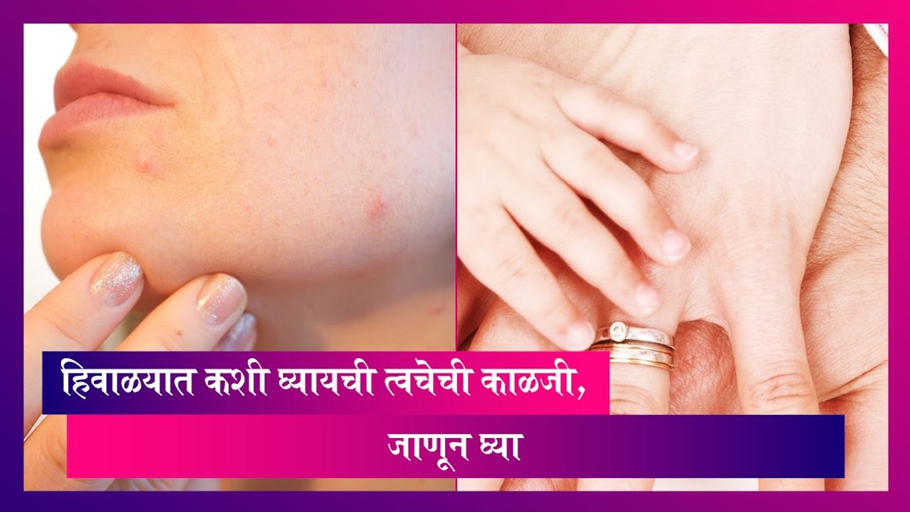 Skin Care Tips For Winter: हिवाळ्यात कशी घ्यायची त्वचेची काळजी; जाणून घ्या
