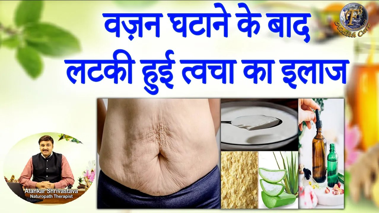 वज़न घटाने के बाद लटकी हुई त्वचा का इलाज | Tighten And Brighten Your Skin Post Weight Loss