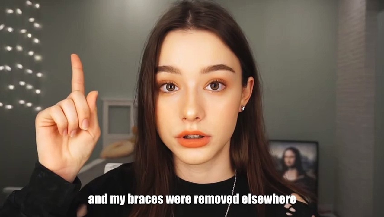 MY BRACES EXPERIENCE THE DOCTOR MESSED UP MY TEETH video Dailymotion