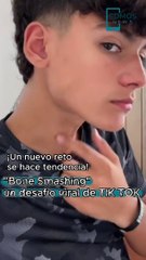 'Bone Smashing', la nueva tendencia que pone en riesgo a los jóvenes