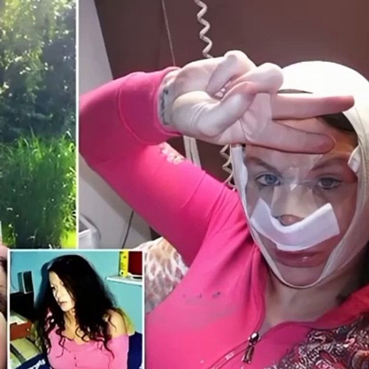 Before and After: 5 Unforgettable Cases of Extreme Plastic Surgery Transformations That Went Viral!