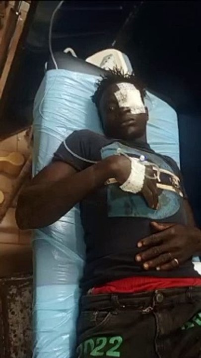 Un homme violemment agressé, son oeil percé