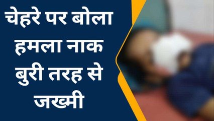 आगरा: आवारा श्वान ने मासूम बच्चे को बनाया अपना निशाना