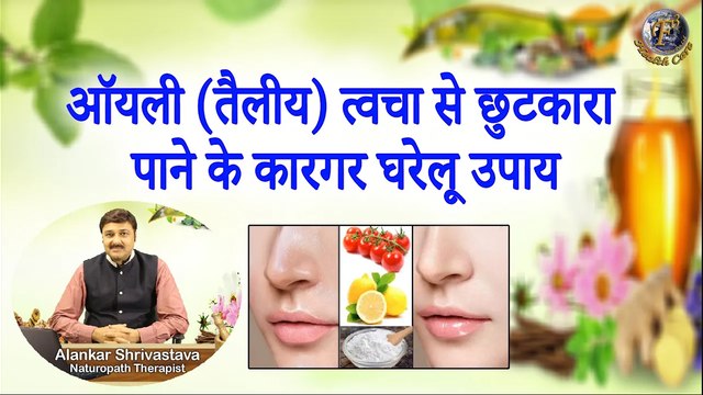 ऑयली (तैलीय) त्वचा से छुटकारा पाने के कारगर घरेलू उपाय | Get Rid Of Oily Skin With Home Remedies |