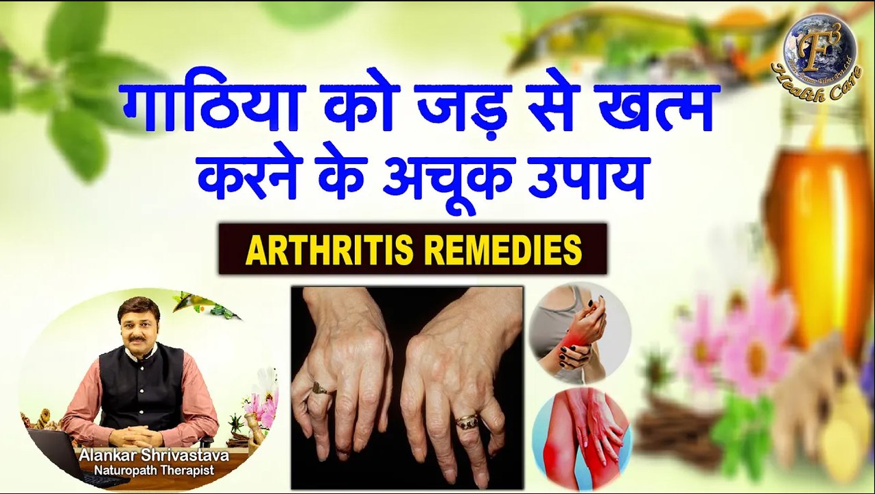 गाठिया को जड़ से खत्म करने के अचूक उपाय | Treat Arthritis (Gout) With Natural Remedies