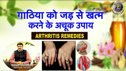गाठिया को जड़ से खत्म करने के अचूक उपाय | Treat Arthritis (Gout) With Natural Remedies