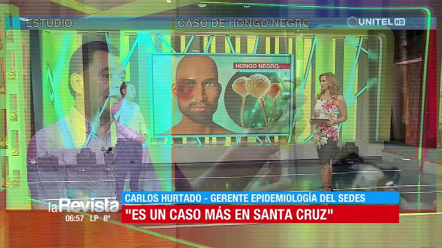 ​Hombre contagiado con hongo negro tiene enfermedad de base, pero está estable