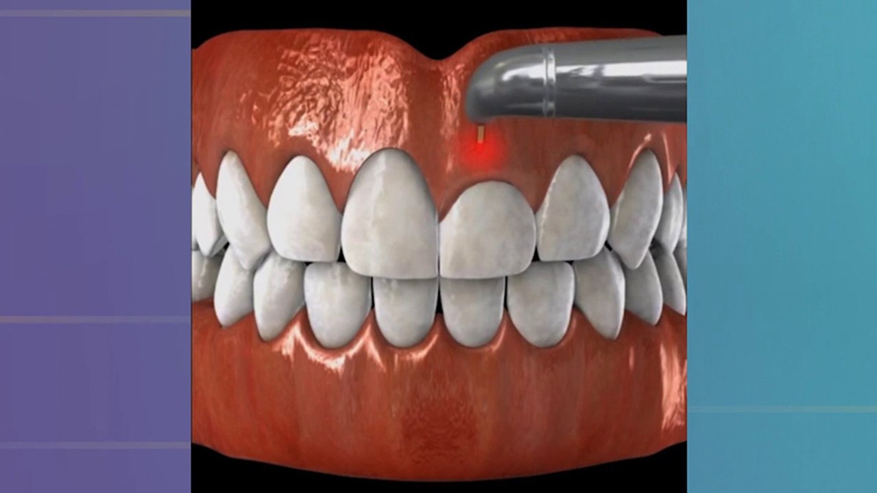 bd-reconstruccion-de-encias-071123