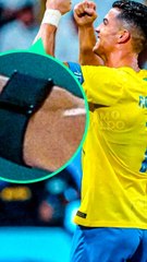  Pourquoi Ronaldo porte ce gadget au poignet ? #alnassr #cristianoronaldo #ronaldo #cr7cristianoronaldo