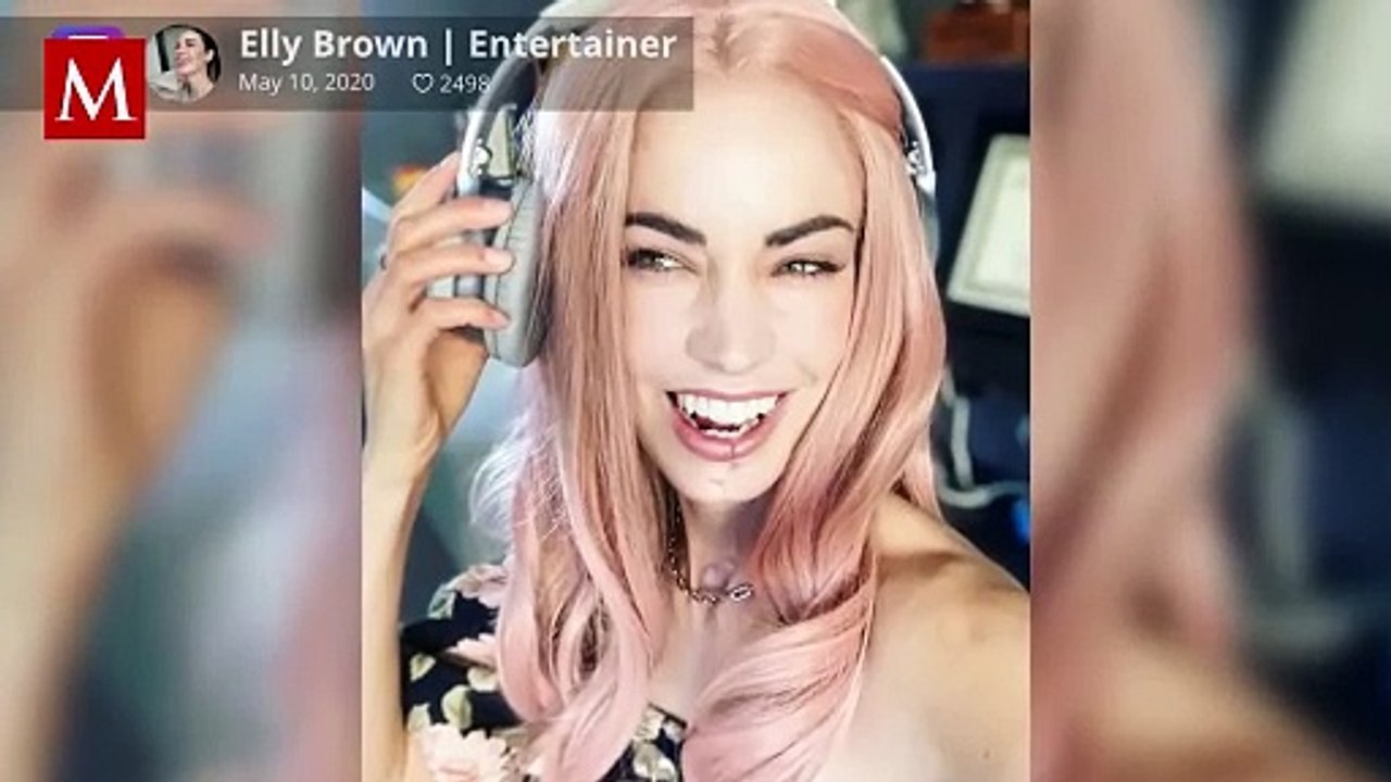 La impactante historia de Elly Brown: Cómo el dentista cambió su vida