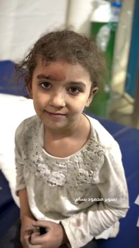 Kabar terbaru Gaza Palestina-Senyum seorang gadis kecil yang terluka di gaza palestina