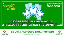 Tipos de Perfil en Ortodoncia: Escoge el que Mejor te Conviene