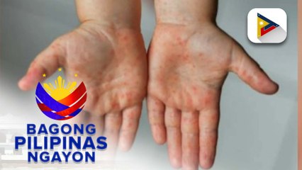 Panayam kay infectious diseases expert Dr. Rontgene Solante